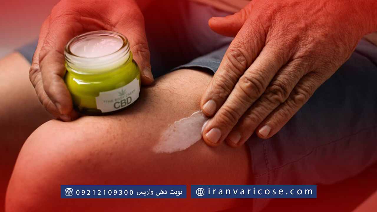 روش‌های طب سنتی برای درمان واریس