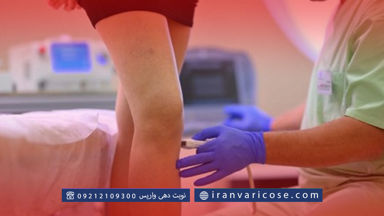 مراقبت های لازم قبل و بعد از درمان واریس با فلبکتومی