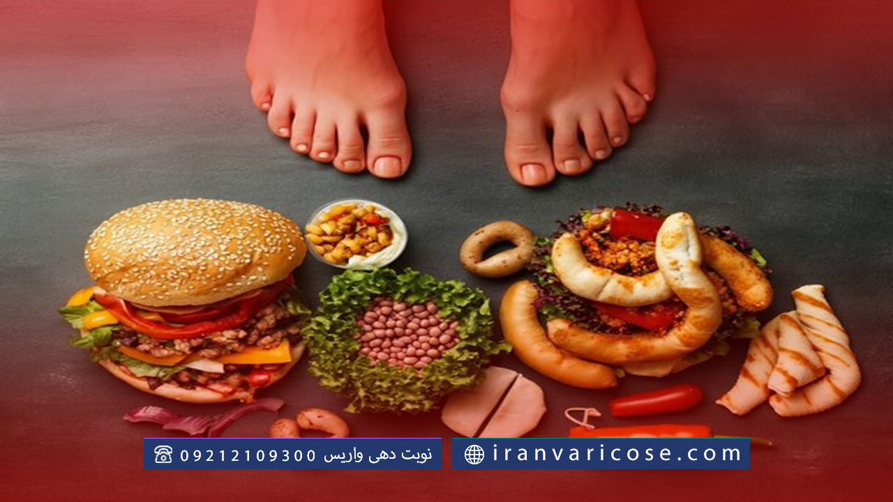 غذاهای مضر برای واریس