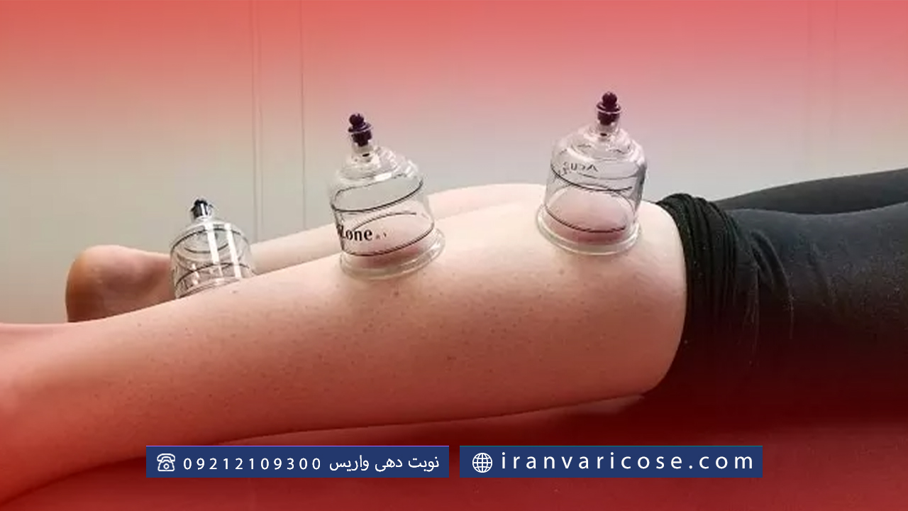 آیا درمان واریس پا به روش حجامت برای همه افراد مناسب است؟