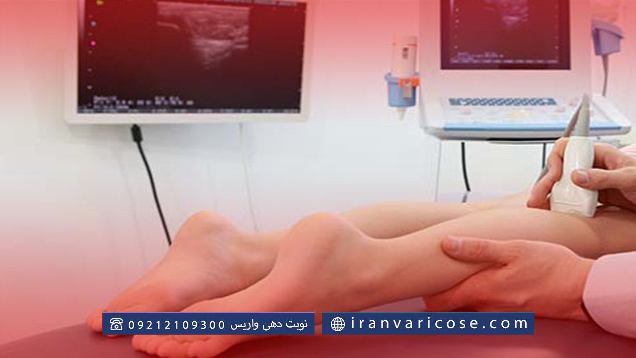 مزایا سونوگرافی داپلر برای واریس