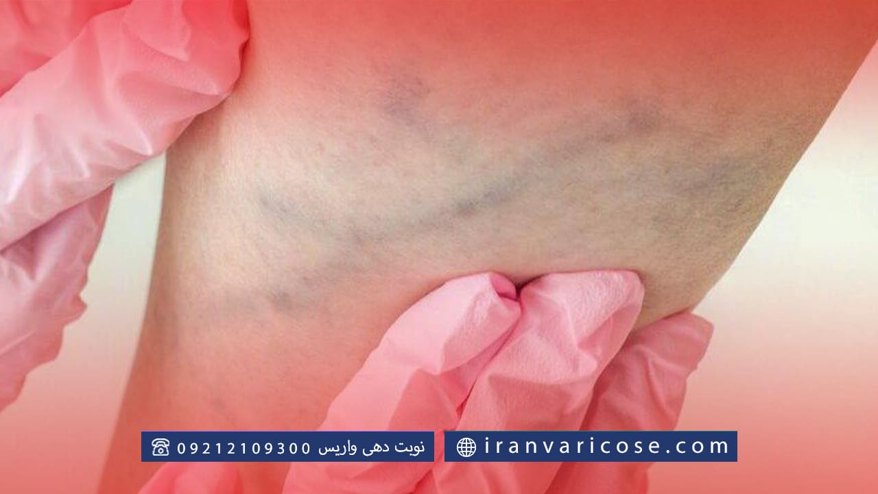 کاربرد های ونوگرافی