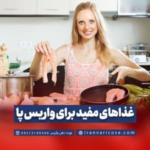 غذاهای مفید برای واریس پا