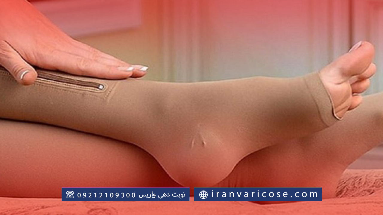 نحوه عملکرد جوراب واریس در بارداری