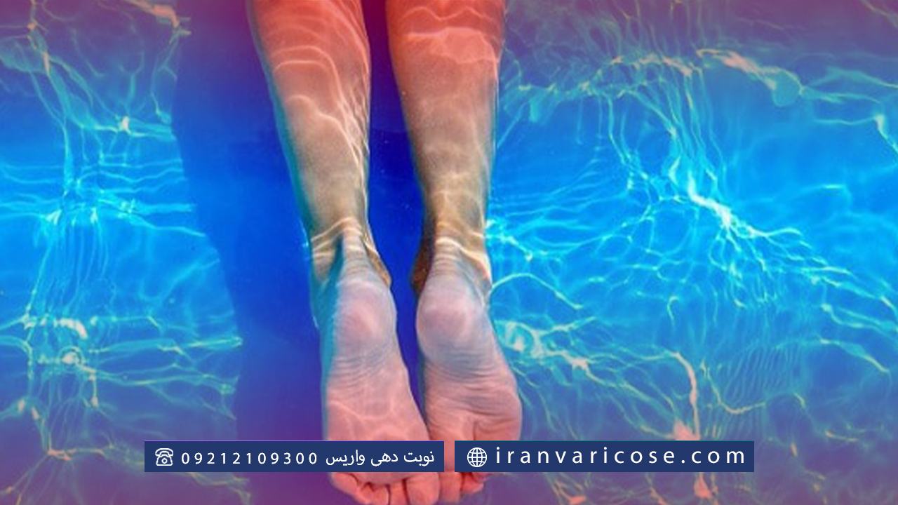 در آب درماني واريس پا از چه گياهان دارويي استفاده کنیم؟