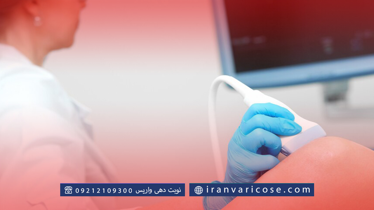 روش های تشخیصی واریس