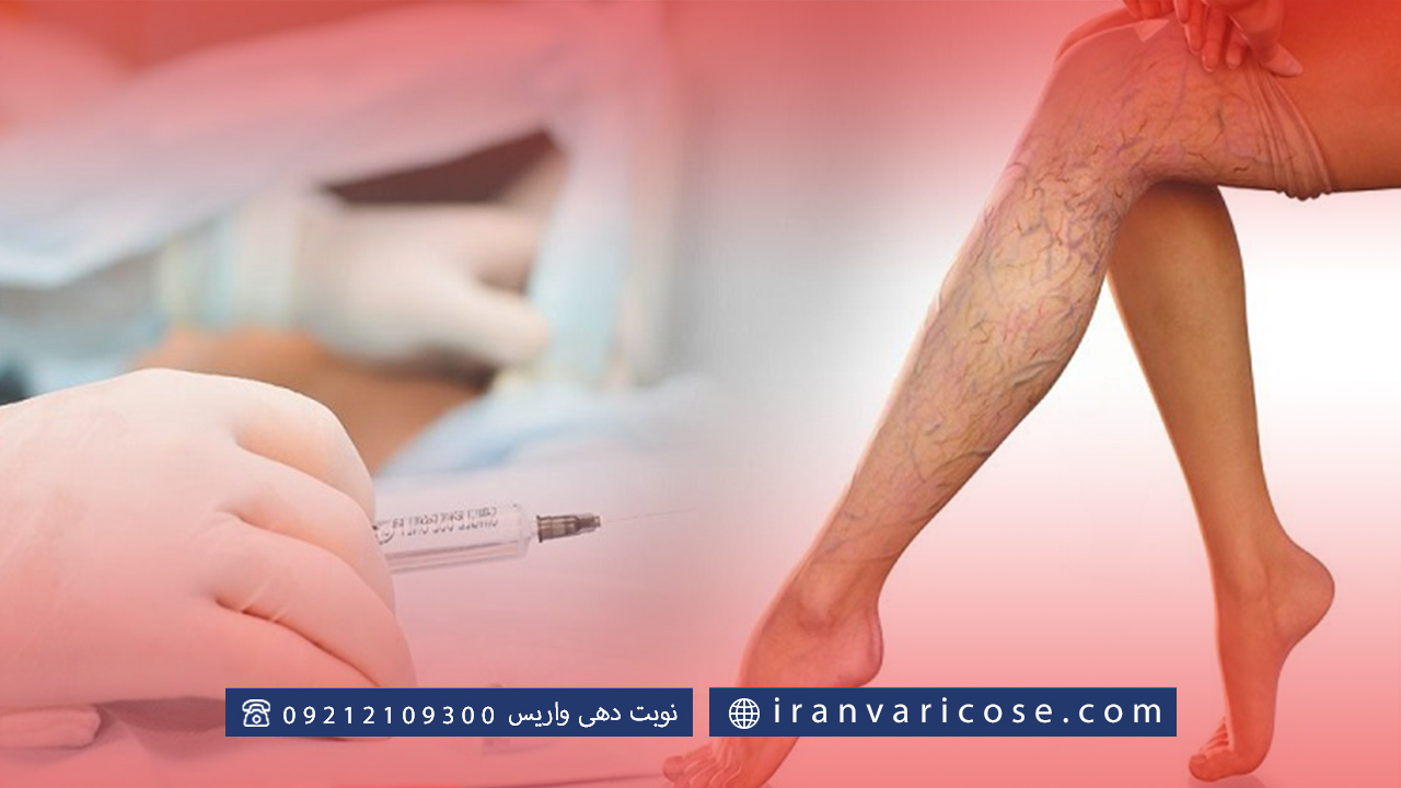 تفاوت‌های اسکلروتراپی و لیزر در درمان واریس
