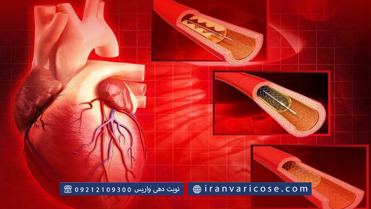 کاربردهای جراحی اندوواسکولار